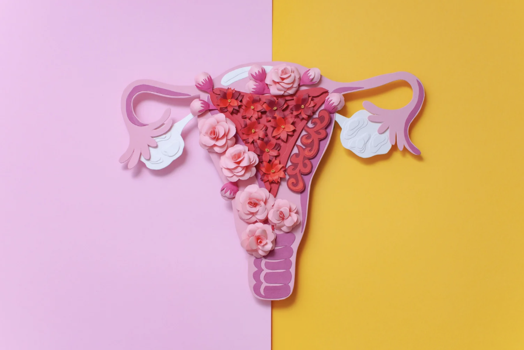 Endometriosis